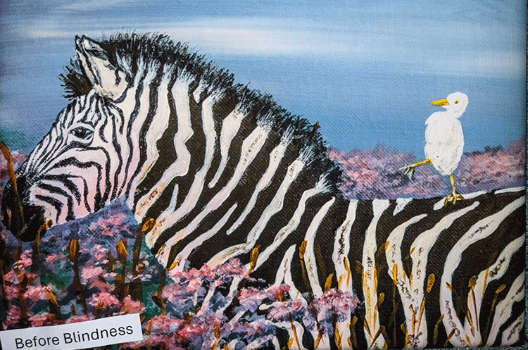 (canvas print) before blindness
