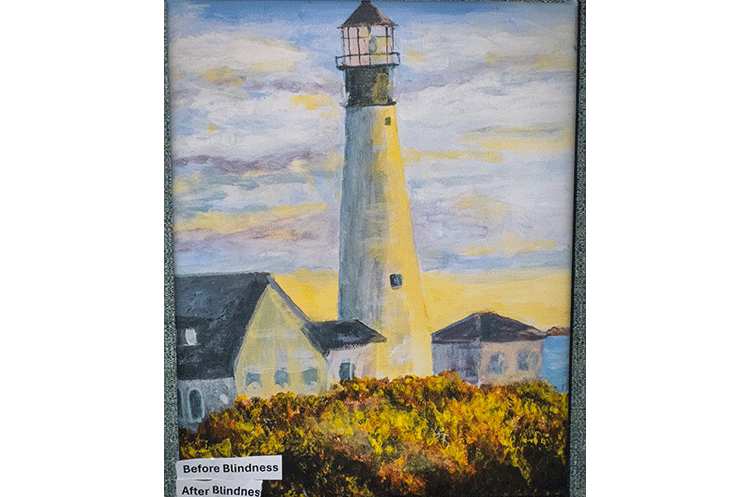 (canvas print) before and after blindness